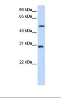 ZNF138 Antibody - 293T cell lysate. Antibody concentration: 1.0 ug/ml. Gel concentration: 12%.  This image was taken for the unconjugated form of this product. Other forms have not been tested.