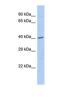 ZNF140 Antibody - Western blot of Human 721_B. ZNF140 antibody dilution 1.0 ug/ml.  This image was taken for the unconjugated form of this product. Other forms have not been tested.