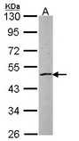 ZNF140 Antibody - Sample (30 ug of whole cell lysate). A: NT2D1. 10% SDS PAGE. ZNF140 antibody diluted at 1:1000.