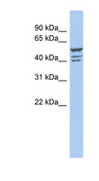 ZNF140 Antibody - ZNF140 antibody Western blot of OVCAR-3 cell lysate. This image was taken for the unconjugated form of this product. Other forms have not been tested.
