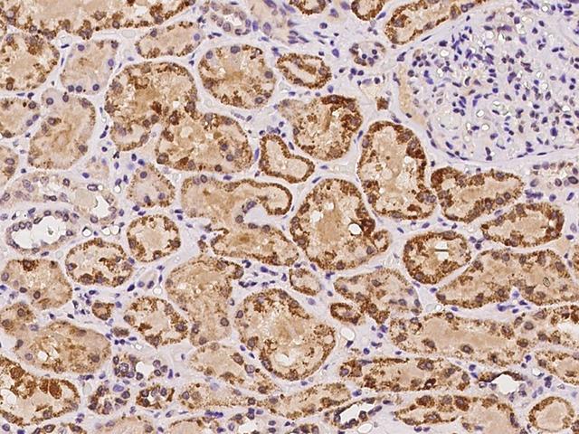 ZNF140 Antibody - Immunochemical staining of human ZNF140 in human kidney with rabbit polyclonal antibody at 1:100 dilution, formalin-fixed paraffin embedded sections.