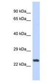 ZNF141 Antibody - ZNF141 antibody Western Blot of Fetal Muscle. Antibody dilution: 1 ug/ml.  This image was taken for the unconjugated form of this product. Other forms have not been tested.