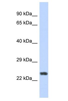 ZNF141 Antibody - ZNF141 antibody Western Blot of Fetal Muscle. Antibody dilution: 1 ug/ml.  This image was taken for the unconjugated form of this product. Other forms have not been tested.