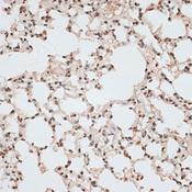ZNF141 Antibody - Immunohistochemistry of paraffin-embedded Mouse lung using ZNF141 Polyclonal Antibody at dilution of 1:100 (40x lens).