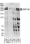 ZNF142 Antibody - Detection of Human ZNF142 by Western Blot. Samples: Whole cell lysate from HeLa (15 and 50 ug), Jurkat (J; 50 ug) and 293T (T; 50 ug) cells. Antibodies: Affinity purified rabbit anti-ZNF142 antibody used for WB at 0.4 ug/ml. Detection: Chemiluminescence with an exposure time of 3 minutes.