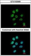 ZNF143 / STAF Antibody - Immunofluorescence of paraformaldehyde-fixed A431 using ZNF143 antibody at 1:500 dilution.