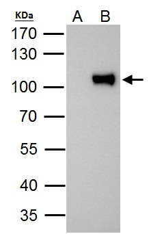 ZNF143 / STAF Antibody - ZNF143 antibody immunoprecipitates ZNF143 protein in IP experiments. IP Sample:293T whole cell lysate/extract A. Control with 2 ug of preimmune rabbit IgG B. Immunoprecipitation of ZNF143 protein by 2 ug of ZNF143 antibody (GTX119360) 7.5% SDS-PAGE The immunoprecipitated ZNF143 protein was detected by ZNF143 antibody (GTX119360) diluted at 1:1000. EasyBlot anti-rabbit IgG (anti-rabbit IgG (HRP) -01) was used as a secondary reagent.