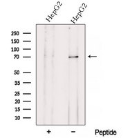 ZNF143 / STAF Antibody - Western blot analysis of extracts of COLO205 cells using ZNF143 antibody. The lane on the left was treated with blocking peptide.