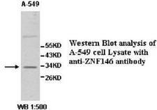 ZNF146 Antibody
