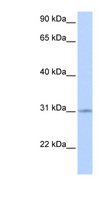ZNF146 Antibody - ZNF146 antibody Western blot of Fetal Heart lysate. This image was taken for the unconjugated form of this product. Other forms have not been tested.