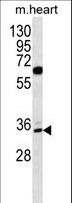 ZNF146 Antibody - ZNF146 Antibody western blot of mouse heart tissue lysates (35 ug/lane). The ZNF146 antibody detected the ZNF146 protein (arrow).