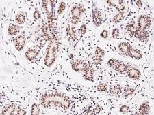 ZNF146 Antibody - Immunochemical staining of human ZNF146 in human breast with rabbit polyclonal antibody at 1:300 dilution, formalin-fixed paraffin embedded sections.