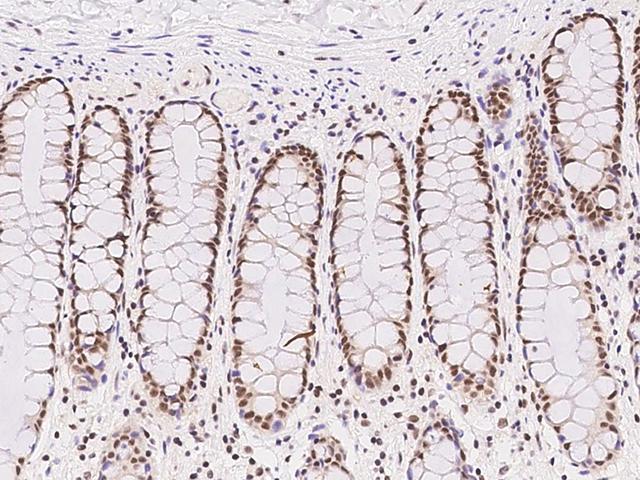 ZNF146 Antibody - Immunochemical staining of human ZNF146 in human rectum with rabbit polyclonal antibody at 1:300 dilution, formalin-fixed paraffin embedded sections.
