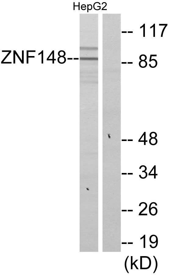 ZNF148 / ZBP-89 Antibody - Western blot analysis of lysates from HepG2 cells, using ZNF148 Antibody. The lane on the right is blocked with the synthesized peptide.
