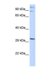 ZNF148 / ZBP-89 Antibody - ZNF148 antibody Western blot of Placenta lysate. This image was taken for the unconjugated form of this product. Other forms have not been tested.