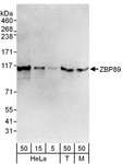 ZNF148 / ZBP-89 Antibody - Detection of Human and Mouse ZBP89 by Western Blot. Samples: Whole cell lysate from HeLa (5, 15 and 50 ug), 293T (T; 50 ug) and mouse NIH3T3 (M; 50 ug) cells. Antibody: Affinity purified rabbit anti-ZBP89 antibody used for WB at 0.1 ug/ml. Detection: Chemiluminescence with an exposure time of 3 minutes.