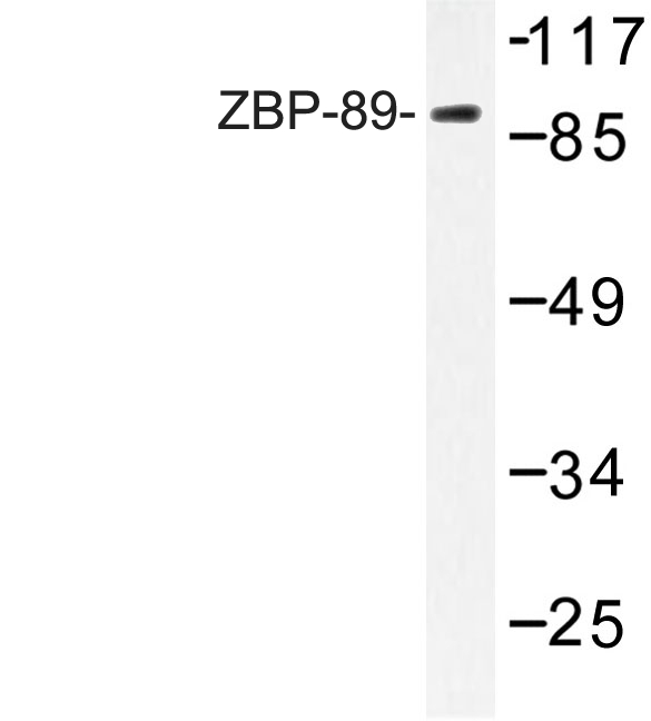 ZNF148 / ZBP-89 Antibody - Western blot of ZBP-89 (E84) pAb in extracts from HepG2 cells.