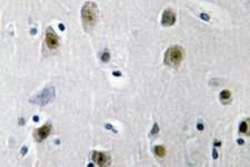 ZNF148 / ZBP-89 Antibody - IHC of ZBP-89 (E84) pAb in paraffin-embedded human brain tissue.