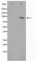 ZNF148 / ZBP-89 Antibody - Western blot of HepG2 cell lysate using ZNF148 Antibody