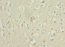 ZNF148 / ZBP-89 Antibody - Immunohistochemistry of paraffin-embedded human brain tissue at dilution 1:100