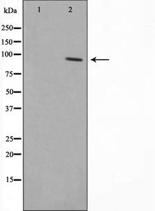 ZNF148 / ZBP-89 Antibody - Western blot analysis on HepG2 cell lysates using ZNF148 antibody. The lane on the left is treated with the antigen-specific peptide.