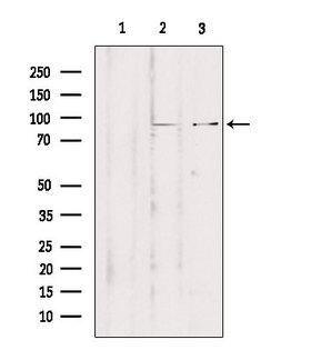 ZNF148 / ZBP-89 Antibody - Western blot analysis of extracts of various samples using ZNF148 antibody. Lane 1: rat brain treated with blocking peptide. Lane 2: rat brain; Lane 3: mouse brain;