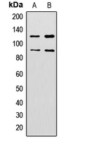 ZNF148 / ZBP-89 Antibody - Western blot analysis of ZNF148 expression in HeLa (A); HepG2 (B) whole cell lysates.
