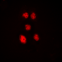 ZNF148 / ZBP-89 Antibody - Immunofluorescent analysis of ZNF148 staining in HeLa cells. Formalin-fixed cells were permeabilized with 0.1% Triton X-100 in TBS for 5-10 minutes and blocked with 3% BSA-PBS for 30 minutes at room temperature. Cells were probed with the primary antibody in 3% BSA-PBS and incubated overnight at 4 deg C in a humidified chamber. Cells were washed with PBST and incubated with a DyLight 594-conjugated secondary antibody (red) in PBS at room temperature in the dark. DAPI was used to stain the cell nuclei (blue).
