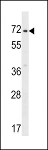 ZNF155 Antibody - ZNF155 Antibody western blot of HepG2 cell line lysates (35 ug/lane). The ZNF155 antibody detected the ZNF155 protein (arrow).