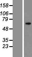ZNF155 Protein - Western validation with an anti-DDK antibody * L: Control HEK293 lysate R: Over-expression lysate