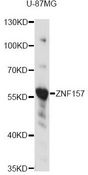 ZNF157 Antibody - Western blot analysis of extracts of U-87MG cells, using ZNF157 antibody at 1:3000 dilution. The secondary antibody used was an HRP Goat Anti-Rabbit IgG (H+L) at 1:10000 dilution. Lysates were loaded 25ug per lane and 3% nonfat dry milk in TBST was used for blocking. An ECL Kit was used for detection and the exposure time was 1s.