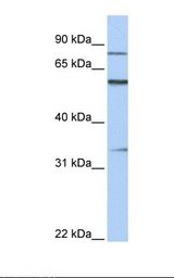 ZNF16 Antibody - Fetal heart lysate. Antibody concentration: 1.0 ug/ml. Gel concentration: 12%.  This image was taken for the unconjugated form of this product. Other forms have not been tested.