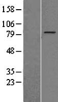 ZNF16 Protein - Western validation with an anti-DDK antibody * L: Control HEK293 lysate R: Over-expression lysate