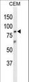 ZNF160 Antibody - Western blot of ZN160 Antibody in CEM cell line lysates (35 ug/lane). ZN160 (arrow) was detected using the purified antibody.
