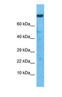 ZNF160 Antibody - Western blot of ZN160 Antibody with human Ovary Tumor lysate.  This image was taken for the unconjugated form of this product. Other forms have not been tested.