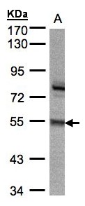 ZNF165 Antibody - Sample (30 ug whole cell lysate). A:293T. 7.5% SDS PAGE. ZNF165 antibody diluted at 1:5000