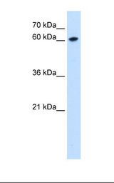 ZNF169 Antibody - HepG2 cell lysate. Antibody concentration: 0.25 ug/ml. Gel concentration: 12%.  This image was taken for the unconjugated form of this product. Other forms have not been tested.