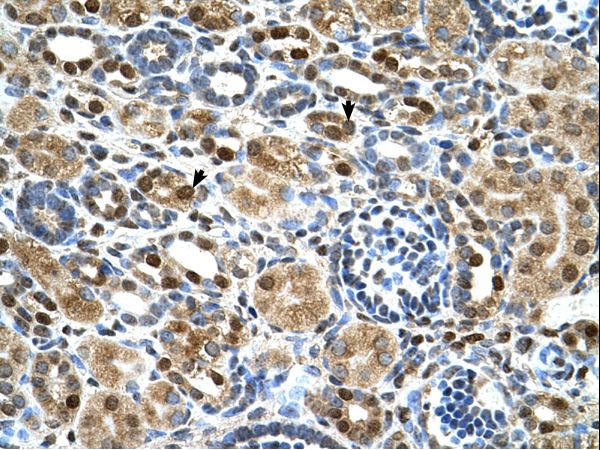 ZNF169 Antibody - ZNF169 antibody ZNF169(zinc finger protein 169) Antibody was used in IHC to stain formalin-fixed, paraffin-embedded human kidney.  This image was taken for the unconjugated form of this product. Other forms have not been tested.