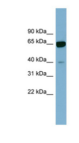 ZNF169 Antibody - ZNF169 antibody Western blot of Fetal Kidney lysate. This image was taken for the unconjugated form of this product. Other forms have not been tested.