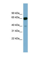 ZNF169 Antibody - ZNF169 antibody Western blot of Fetal Kidney lysate. This image was taken for the unconjugated form of this product. Other forms have not been tested.