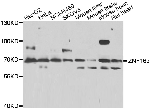 ZNF169 Antibody - Western blot analysis of extracts of various cell lines.