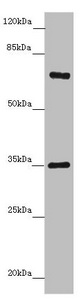 ZNF169 Antibody - Western blot All Lanes: ZNF169antibody at 5.32ug/ml+ Hela whole cell lysate Goat polyclonal to rabbit at 1/10000 dilution Predicted band size: 68 kDa Observed band size: 68,34 kDa