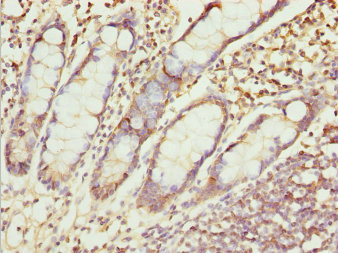 ZNF169 Antibody - Immunohistochemistry of paraffin-embedded human small intestine tissue at dilution 1:100