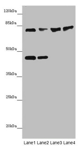 ZNF169 Antibody - Western blot All Lanes: ZNF169antibody at 2ug/ml Lane 1: HepG-2 whole cell lysate Lane 2: Hela whole cell lysate Lane 3: Mouse liver tissue Lane 4: Mouse kidney tissue Secondary Goat polyclonal to Rabbit IgG at 1/10000 dilution Predicted band size: 68 kDa Observed band size: 68,45 kDa