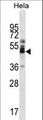 ZNF174 Antibody - ZNF174 Antibody western blot of HeLa cell line lysates (35 ug/lane). The ZNF174 antibody detected the ZNF174 protein (arrow).