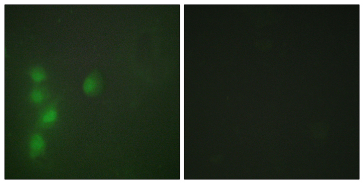 ZNF174 Antibody - Immunofluorescence analysis of HUVEC cells, using ZNF174 Antibody. The picture on the right is blocked with the synthesized peptide.