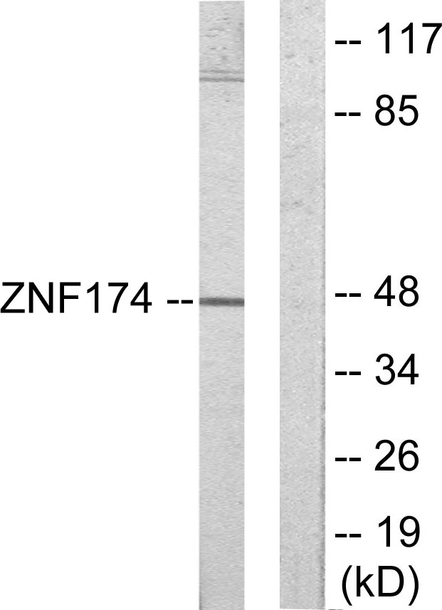 ZNF174 Antibody - Western blot analysis of lysates from HeLa cells, using ZNF174 Antibody. The lane on the right is blocked with the synthesized peptide.