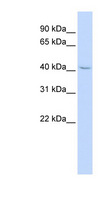ZNF174 Antibody - ZNF174 antibody Western blot of HepG2 cell lysate. This image was taken for the unconjugated form of this product. Other forms have not been tested.