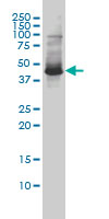 ZNF174 Antibody - ZNF174 monoclonal antibody (M01), clone 2D7-E9 Western Blot analysis of ZNF174 expression in SW-13.