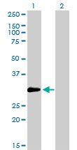ZNF174 Antibody - Western Blot analysis of ZNF174 expression in transfected 293T cell line by ZNF174 monoclonal antibody (M01), clone 2D7-E9.Lane 1: ZNF174 transfected lysate(26 KDa).Lane 2: Non-transfected lysate.